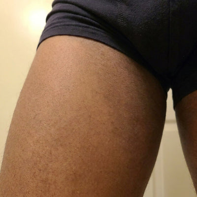 Visible Skin Improvement
