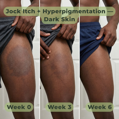 Ironbark Natural Antifungal Soap Bar