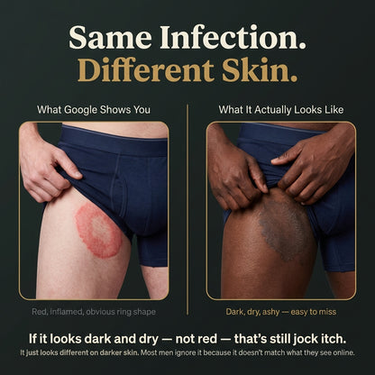 Ironbark Natural Antifungal Soap Bar